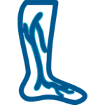 Cirugía Vascular